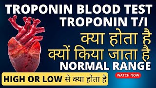 Troponin test in hindi  Troponin t test  troponin test normal range  troponin i test [upl. by Lipps]