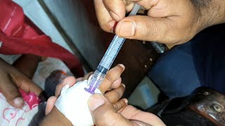 Child Meropenem 250mg amp Amikacin intravenous injection Video 24 Ep 71 Injection Tips [upl. by Ellimaj]