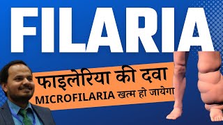 Filaria ki dawa Treatment of microfilaria Filariasis ka ilaaz Dr Pratyush Kumar [upl. by Kenlay]