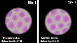 Study of Plasmolysis  MeitY OLabs [upl. by Eppie768]