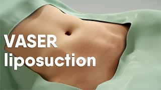 VASER liposuction is also called ultrasoundassisted liposuction VASER lipo or LipoSculpting [upl. by Bonnie]