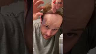 Breaking Down Hair System Installation for You  Lordhair Men‘s Hairpieces [upl. by Huoh]