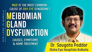 Meibomian Gland Dysfunction Causes Symptoms and remedy for dry eyes MGD by Dr Saugata Poddar [upl. by Isabella]