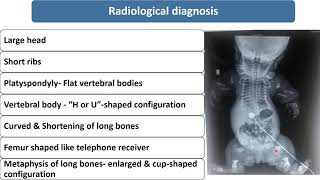 Thanatophoric Dysplasia  Spot Diagnosis  2  Pediatrics [upl. by Eenobe]