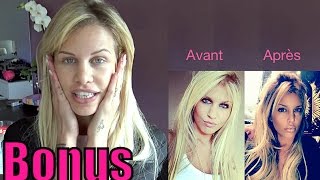 ADIXIA LMSA quotJai trop abusé de la chirurgie jétais plus la même 💉quot INÉDIT [upl. by Nnazil]