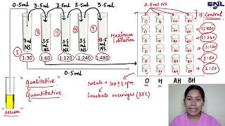 Widal Test  Typhoid Test [upl. by Dnarb379]