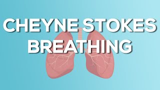 Cheyne Stokes Breathing  Causes Demonstration Treatment [upl. by Leval]