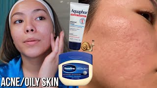 Viral Skincare Slugging using Vaseline and Aquaphor [upl. by Llehsar]