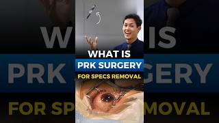 What Is PRK Eye Surgery [upl. by Ulphi]