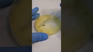 Bacteria vs Ginger Battling 🦠🦠🦠🦠🦠🦠 🔬🔬🔬🔬🔬🔬🔬 [upl. by Anilad134]