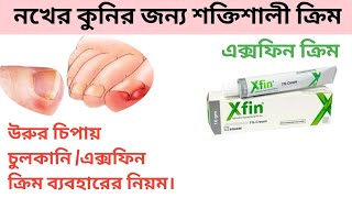 xfin cream এর কাজ কি।xfin cream ব্যবহার নিয়ম।xfin cream review in bangla [upl. by Ramon]