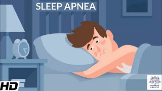 Sleep Apnea CausesSigns and Symptoms DIagnosis and Treatment [upl. by Micky]