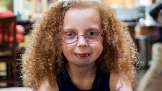 7YearOld Girl Gets New Jaw Made from Rib Bones in Rare Surgery [upl. by Amluz]