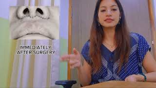 WHAT IS A LIP LIFT SURGERY [upl. by Llerryt]