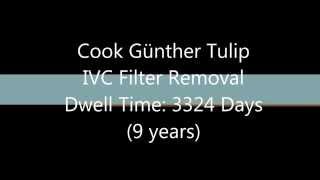 IVC Filter Removal After 9 Years Dwell Time [upl. by Hnim221]