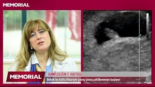 7 haftalık gebelik döneminde neler oluyor [upl. by Torray]