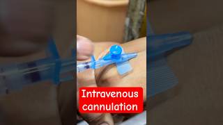 Intravenous iv Cannulation  trending hospital cannula doctor SMpharmacy subscribe [upl. by Bridge646]