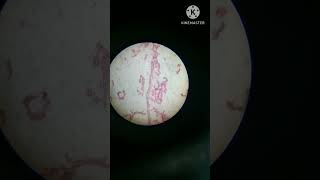 Sycon in microscope like subscribe for more videos BSc [upl. by Anirahc223]