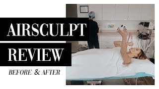 5Month Airsculpt Review  Before amp After [upl. by Pammie]