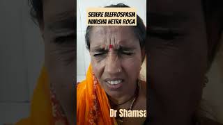 A Case of Blepharospasm Nimisha Netra Roga niajaipur dr Shamsa fiaz [upl. by Junius]