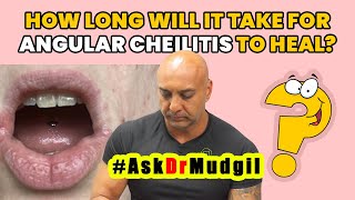 HOW LONG WILL IT TAKE FOR ANGULAR CHEILITIS TO HEAL [upl. by Anauqahs]