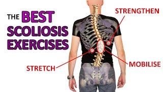 THE Best Exercises For Scoliosis [upl. by Marni]