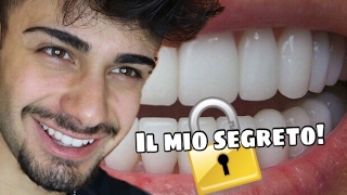 DENTI BIANCHI SUBITO IL MIO SEGRETO  VinkLob [upl. by Gruver]