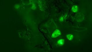 Fluorescence  Acridine Orange vs MitoTracker Green [upl. by Winsor]