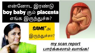 gender prediction during pregnancy in tamil  how to find baby boy or girl in scan report in tamil [upl. by Schuman]