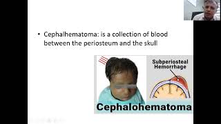 neonate assessment 2 [upl. by Steffy]