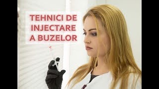 Tehnici de injectare a buzelor cu acid hialuronic [upl. by Hecker826]