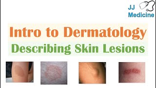 Introduction to Dermatology  The Basics  Describing Skin Lesions Primary amp Secondary Morphology [upl. by Cook]