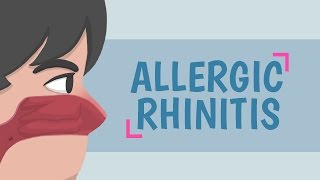 What is Allergic Rhinitis [upl. by Helmer]