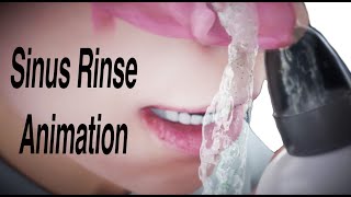 Sinus Rinse Animation [upl. by Elyrpa351]