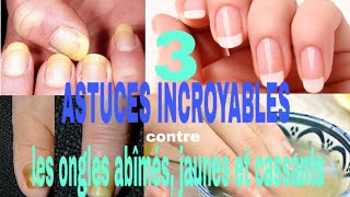 COMMENT SOIGNER LES ONGLES JAUNES CASSANTS ET ABÎMÉS EN QUELQUES JOURS 3ASTUCES NATURELLES [upl. by Htabazile]