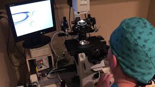 IVF ICSI Procedure in the Lab Part 2 [upl. by Arnaud]