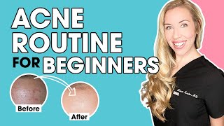 Acne Skincare Routine for Beginners  The Budget Dermatologist [upl. by Tasha]