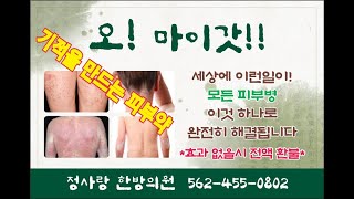 건강 피부병을 치료하는 기적의 피부 연고  Miracle Skin Ointment That Cure All Skin Diseases 사랑과 은혜 313 [upl. by Gaeta]