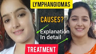 LYMPHANGIOMAexplanation in detailhow I treated it👍 CAUSES TYPES AND SYMPTOMS [upl. by Aehta]