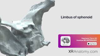 Limbus of sphenoid of sphenoid bone [upl. by Nimar]