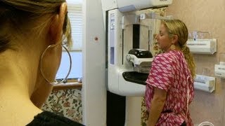 3D mammograms detect more breast cancers study shows [upl. by Ahsemrak]