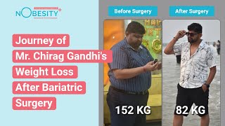 From Overweight Challenges to Positive Recognition Mr Chirag Gandhis Life After Bariatric Surgery [upl. by Lenci163]