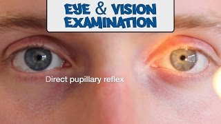 Examination of the Eyes and Vision  OSCE Guide old version  UKMLA  CPSA [upl. by Pokorny]