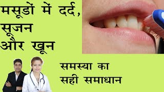 मसूडों में दर्दसूजन और खून आने की समस्या का सही समाधान।Masudo Me Dard Ka Ilaj in Hindi Gingivitis [upl. by Ycram]