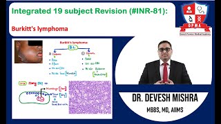 🕉 Integrated 19 subject Revision INR81 Burkitts lymphoma by Dr Devesh Mishra [upl. by Lanae454]