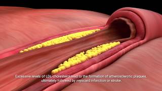 Lactobacillus plantarum INDUCIA [upl. by Ecirp]