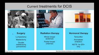 DCIS What You Need to Know [upl. by Norraj]