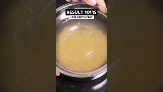 hair fall aloe vera home remedies stop hair fall hair damage [upl. by Alain]