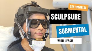 Sculpsure Submental Double Chin Results  San Antonio TX  Sculpt Away [upl. by Yttik]