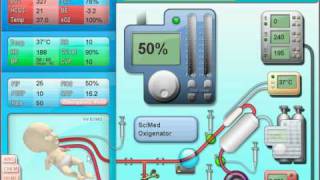 ECMOjo Tutorial 1 [upl. by Ganny]